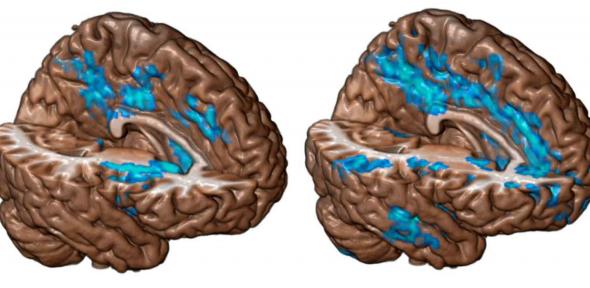 Molecular Psychiatry