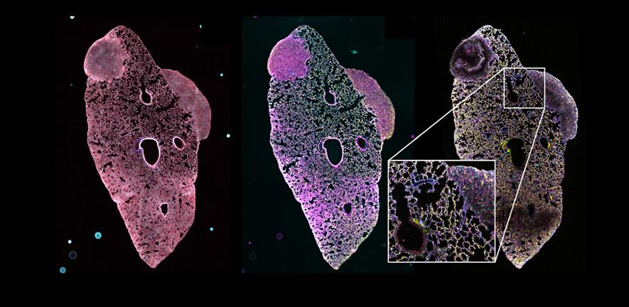 Lung with two metastatic lesions derived from a mouse primary triple-negative breast tumour